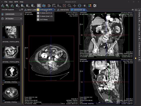 Weasis DICOM medical viewer :: Weasis Documentation.